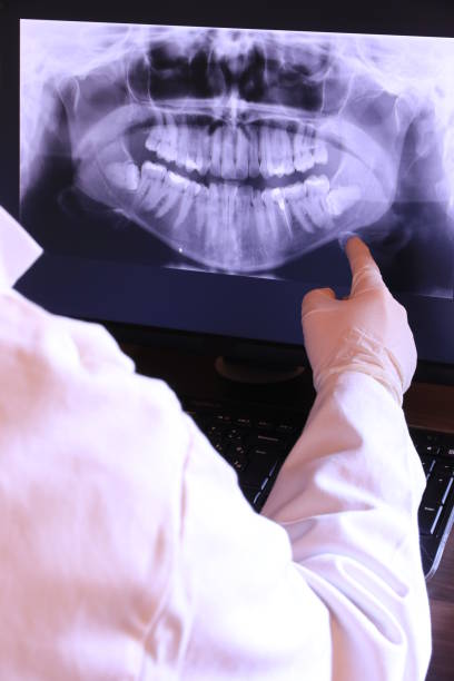 Best Chipped Tooth Repair Near Me  in Tower Lakes, IL