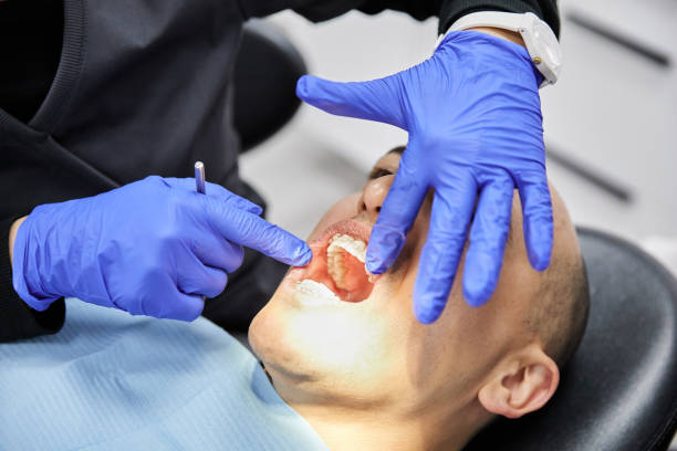 Best Dentist for Dental Trauma  in Tower Lakes, IL